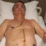Santa Fe: se olvidaron un bisturí eléctrico en las piernas de una mamá y quemaron a su bebé
